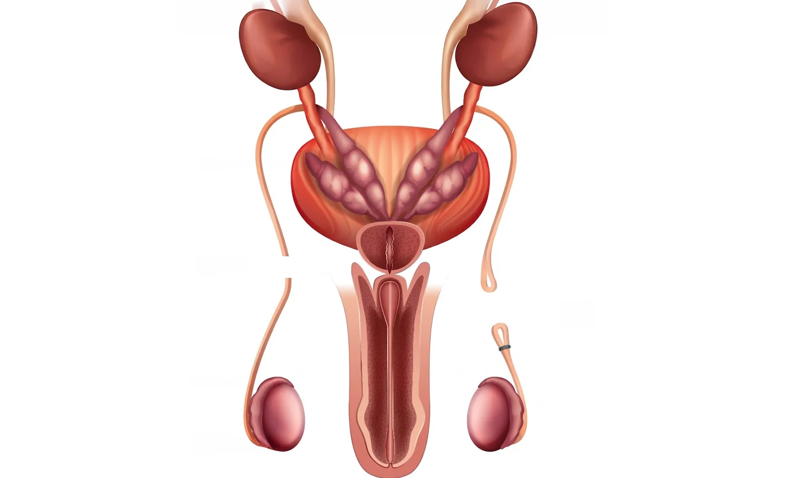 무도(칼을 쓰지 않는) 정관수술